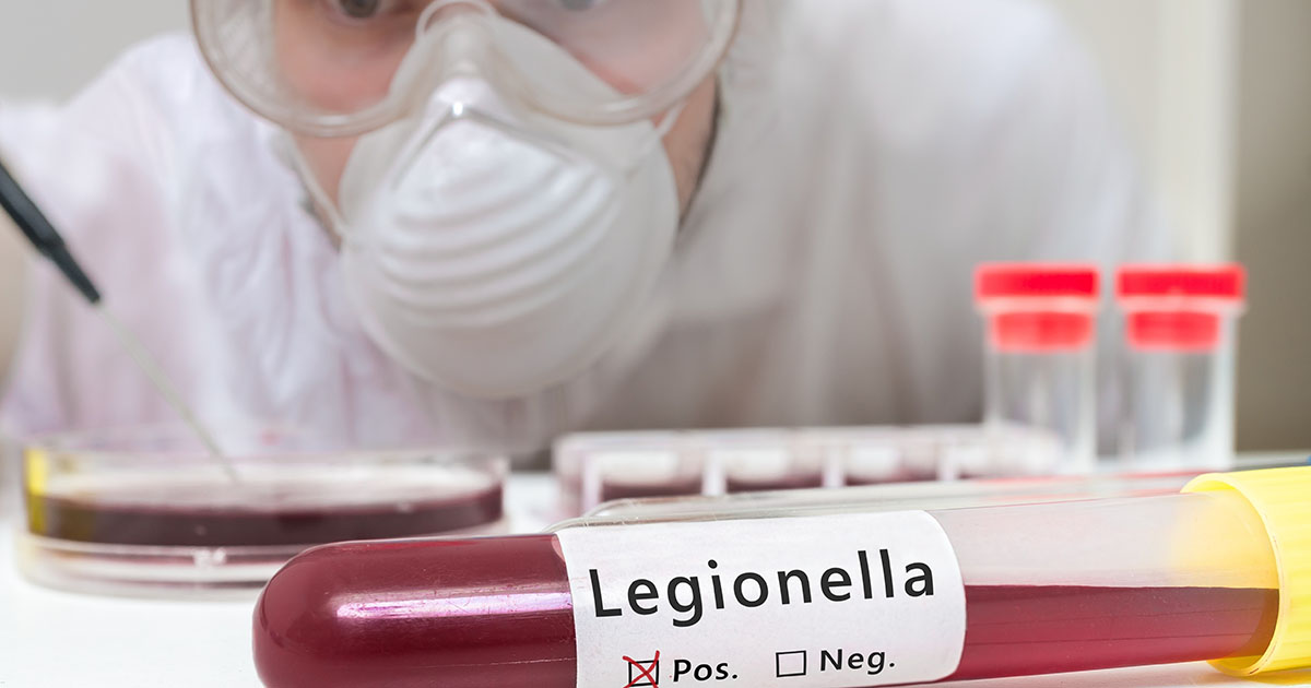 Legionella