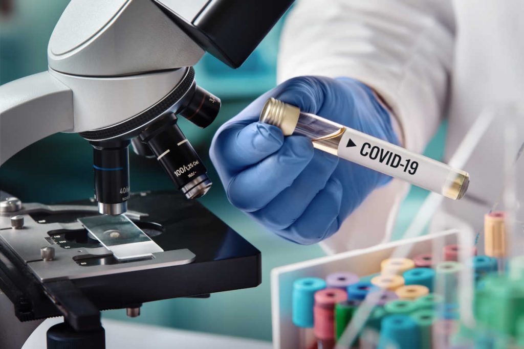 Laboratório testando covid-19 | Foto: Shutterstock