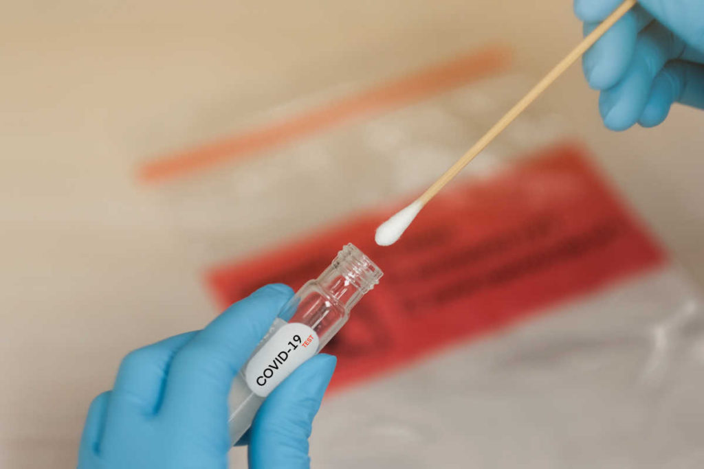 Teste swab para novo coronavírus | Foto: Shutterstock