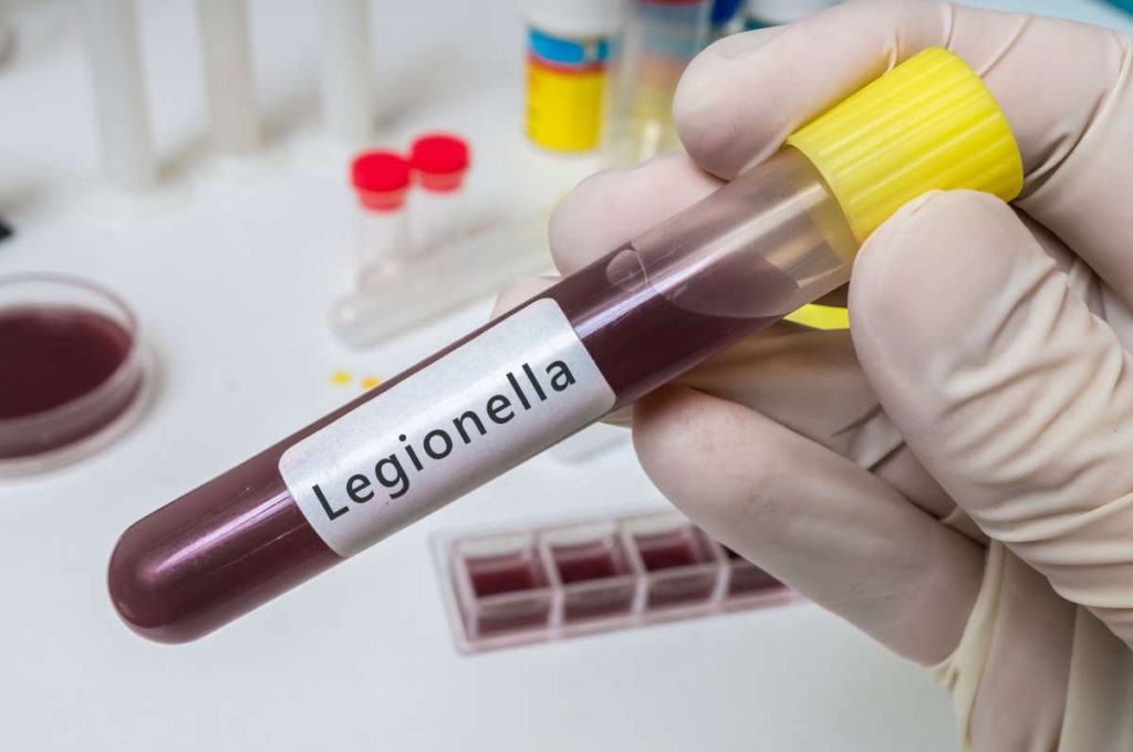 Amostra de sangue de pessoa contaminda com a doença dos legionários, infecção pulmonar causada pel batéria Legionella